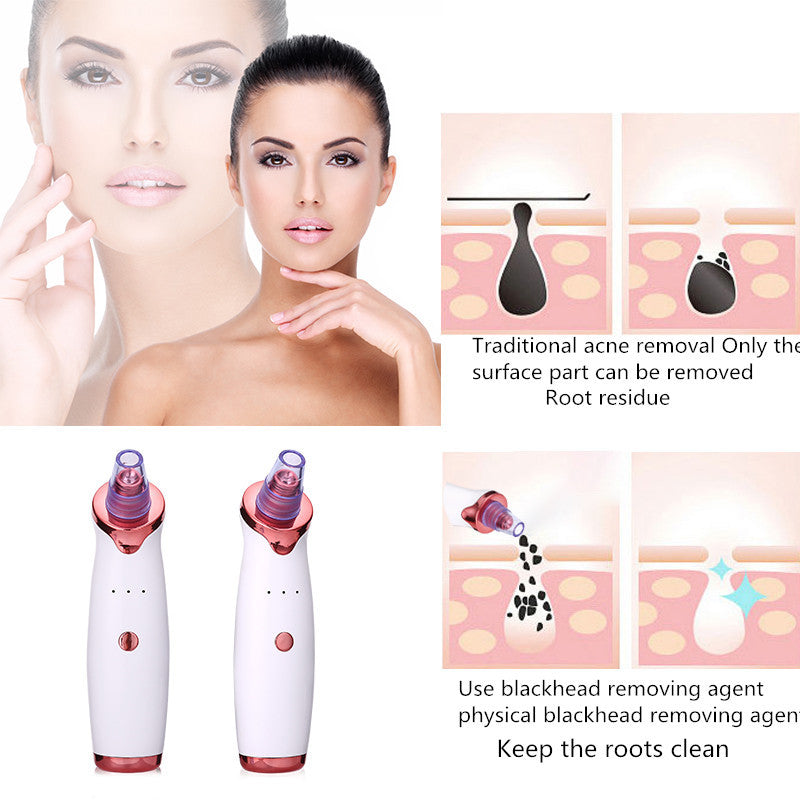 Blackhead Remover & Acne Vacuum